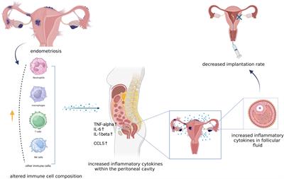 Endometriosis and aspirin: a systematic review